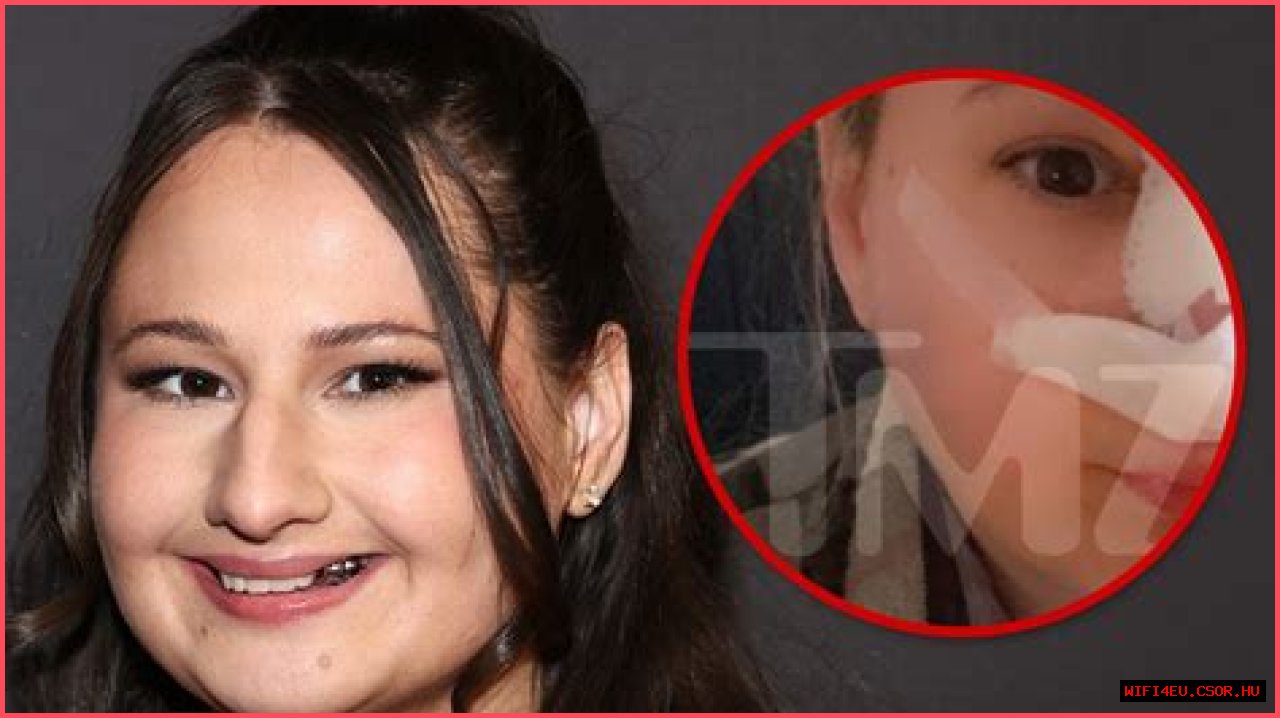 Unveiling The Transformation: The Nose Job Of Gypsy Rose
